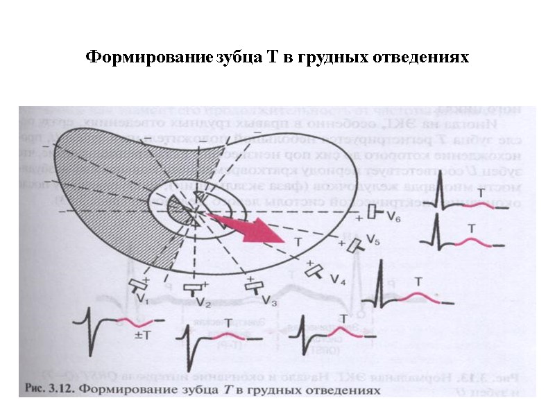 Формирование зубца Т в грудных отведениях